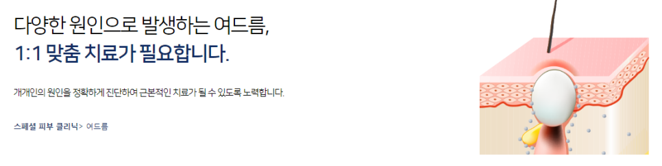 여드름관리 원인을 파악해야 관리할 수 있습니다 관련 이미지 4