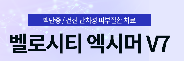 백반증초기 넓어지기전에 증상 발견하면 치료받으세요 관련 이미지 6