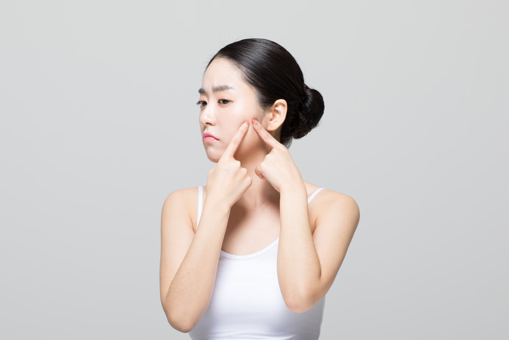 화농성여드름원인 타임리스에서 알아보자 관련 이미지 2