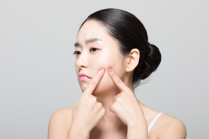 화농성여드름원인 치료 어떤 방법이 있을까? 관련 이미지 3