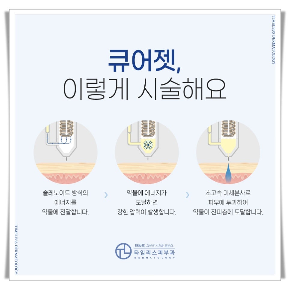 Mapo CUREJET: A Solution for Scar Improvement image 3