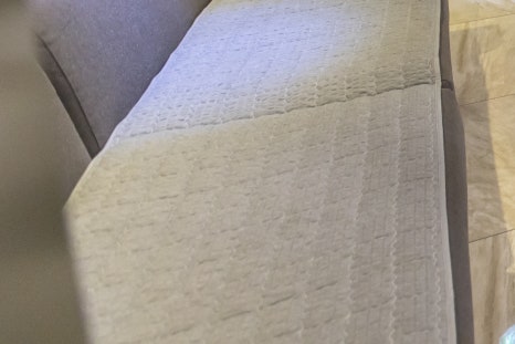 오타양모반치료 얼룩졌던 피부와 이별을 관련 이미지 20