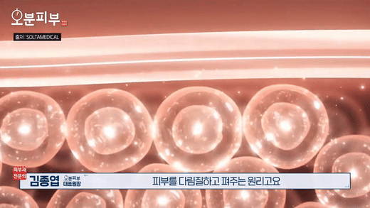 Gongdeok Dermatology Clinic: Essential Criteria to Check Before Choosing Between Ultherapy and Thermage image 7