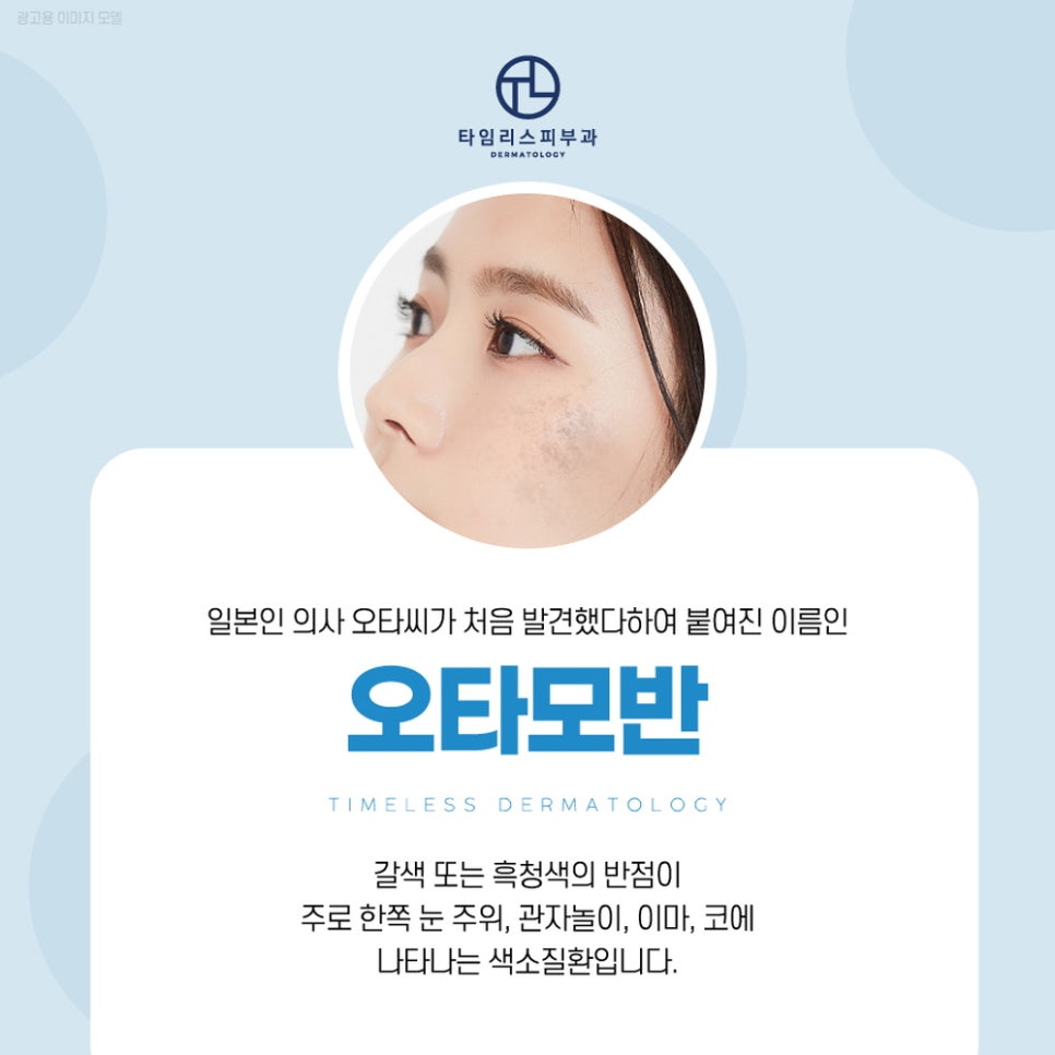 난치성색소질환 치료 알아보면? 관련 이미지 3