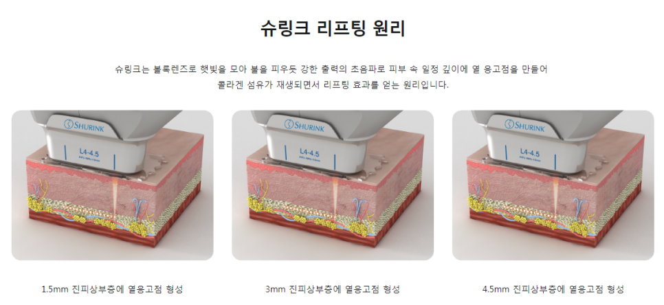 슈링크잘하는곳(피부과) 타임리스가 설명해줄게 드루와 관련 이미지 5