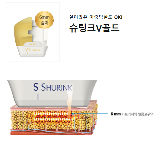 슈링크효과 처지고 탄력잃은피부 주름개선방법 관련 이미지 6