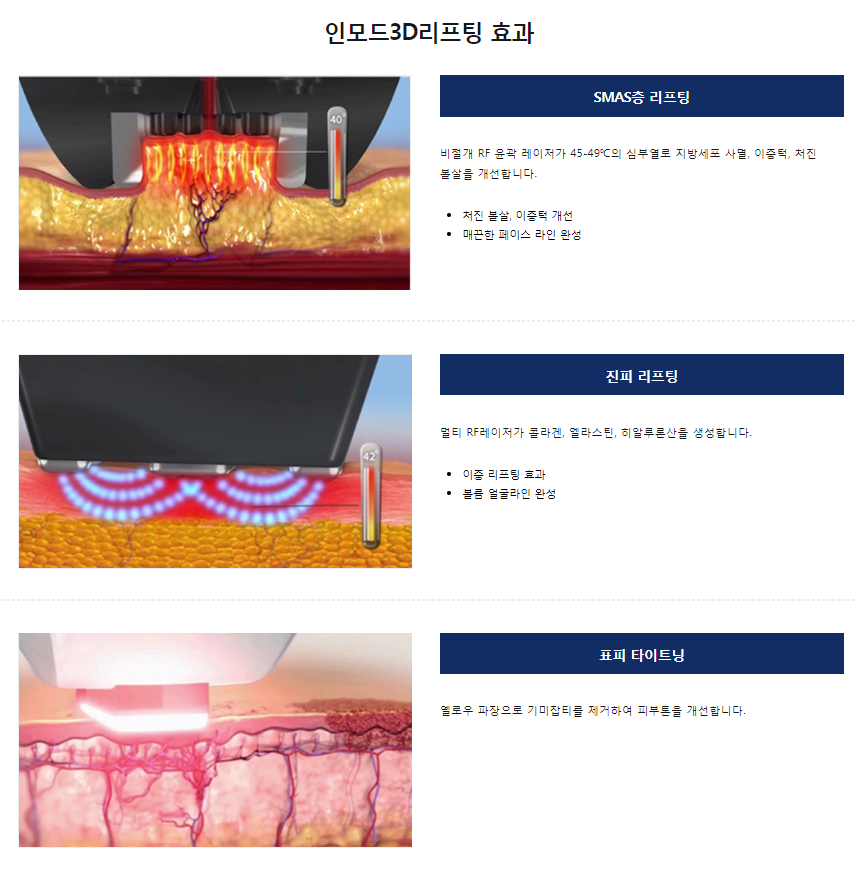 마포구피부과 타임리스에서 인모드리프팅으로 동안등극! 관련 이미지 5