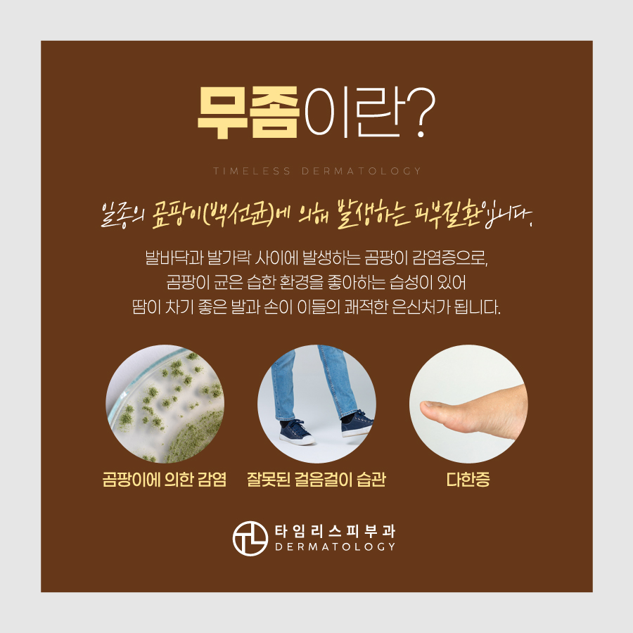 손발톱무좀 치료는 타임리스피부과! 관련 이미지 3