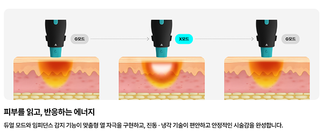 마포 올리지오X 왜 기존 고주파와 다를까 관련 이미지 3