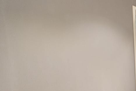 티타늄레이저로 즉각적인 변화를 관련 이미지 15