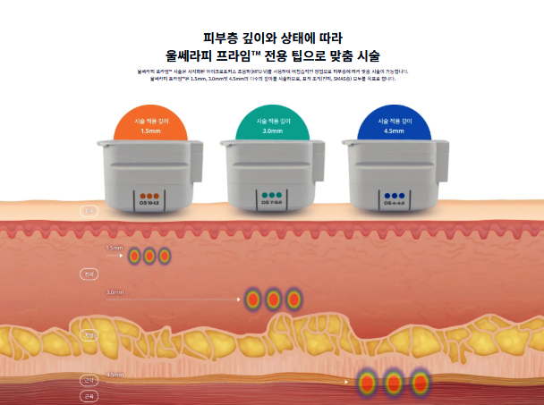 정확도가 다른 리프팅을 찾고 계신다면 마포 울쎄라피 프라임 관련 이미지 3