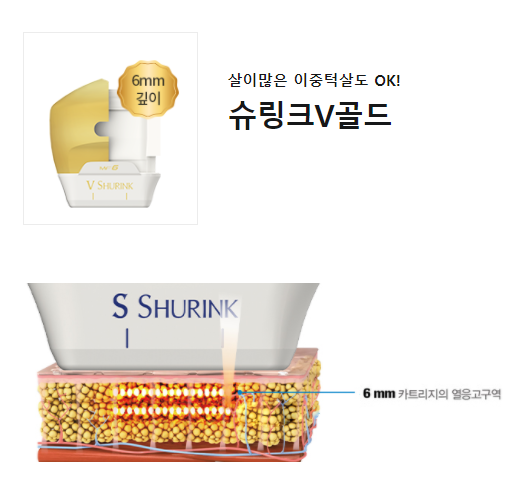 턱선 리프팅 갸름하게 슈링크효과 확인하세요 관련 이미지 5