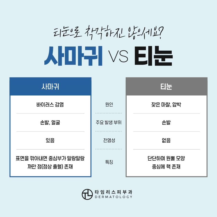 마포사마귀 레이저 치료 가능할까 관련 이미지 4