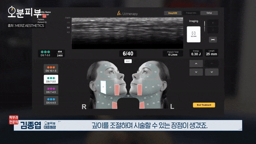 애오개역피부과, 울쎄라 리프팅 볼패임? 걱정된다면 관련 이미지 5