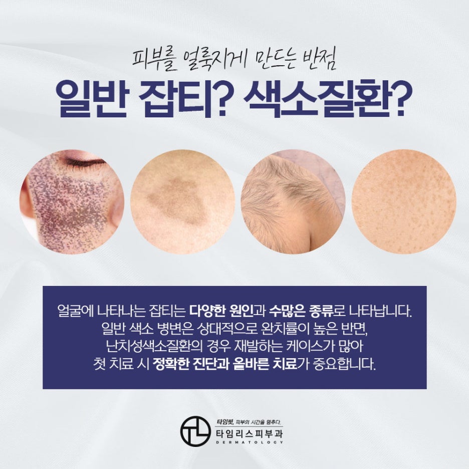밀크커피반점치료를 통해 얼룩진 피부를 깨끗하게 관련 이미지 2