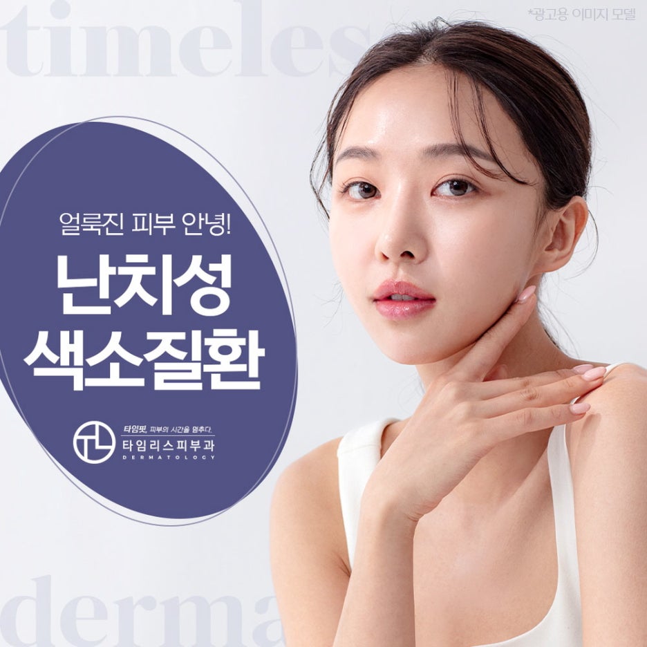 오타양모반치료 얼룩졌던 피부와 이별을 관련 이미지 1