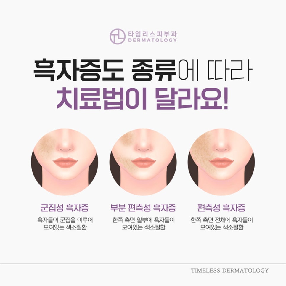 마포피부과전문의 색소질환 정밀한 진단 필요해! 관련 이미지 4