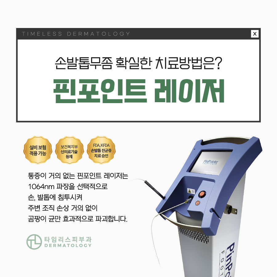 발톱무좀치료방법 당당히 드러내려면 관련 이미지 5