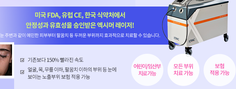 백반증원인 멜라닌색소 꾸준한 치료가 필요합니다 관련 이미지 5