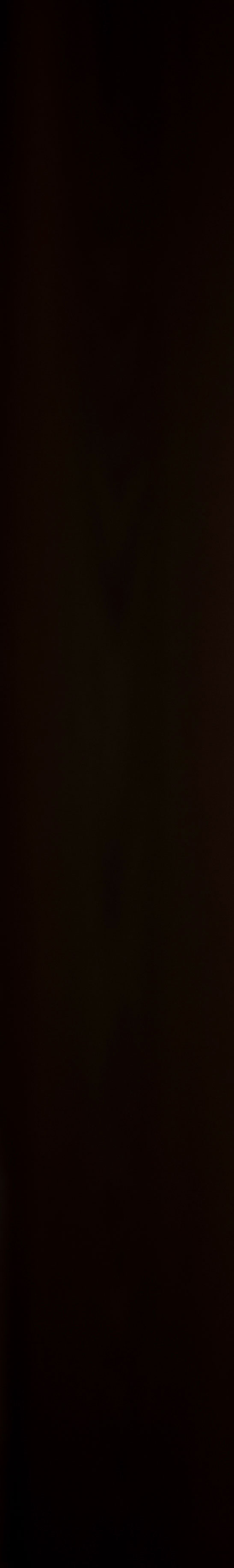 애오개역 피부과 시술 하나로 다 좋아질 거라 생각했다면 관련 이미지 16