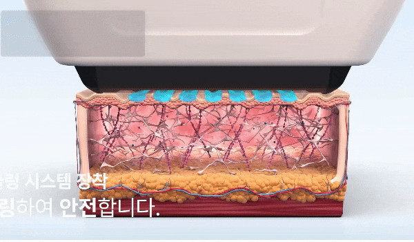 공덕피부과 소프웨이브 리프팅, 처음이라면 이것만 알고 가세요 관련 이미지 4