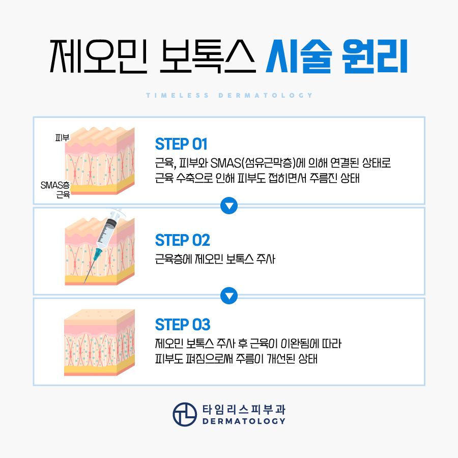 신촌피부과 보톡스 통해 부위별 효과를 관련 이미지 4