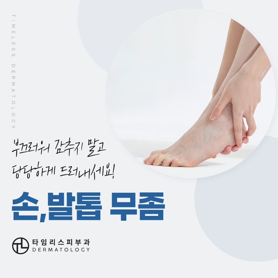 손발톱무좀 치료는 타임리스피부과! 관련 이미지 7