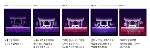 마포 써마지FLX 2대 운영으로 대기를 줄였습니다. 관련 이미지 3