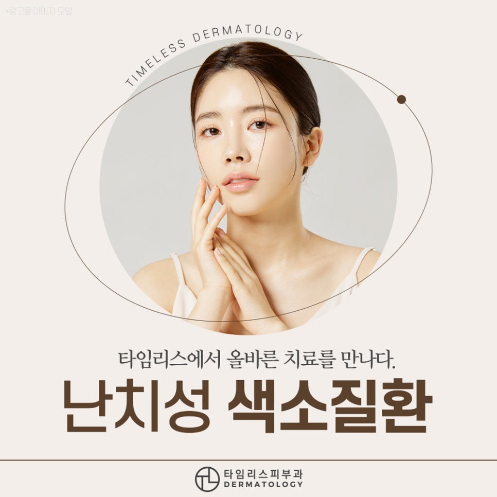 후천성오타모반 올바른 치료 방법으로 관련 이미지 1