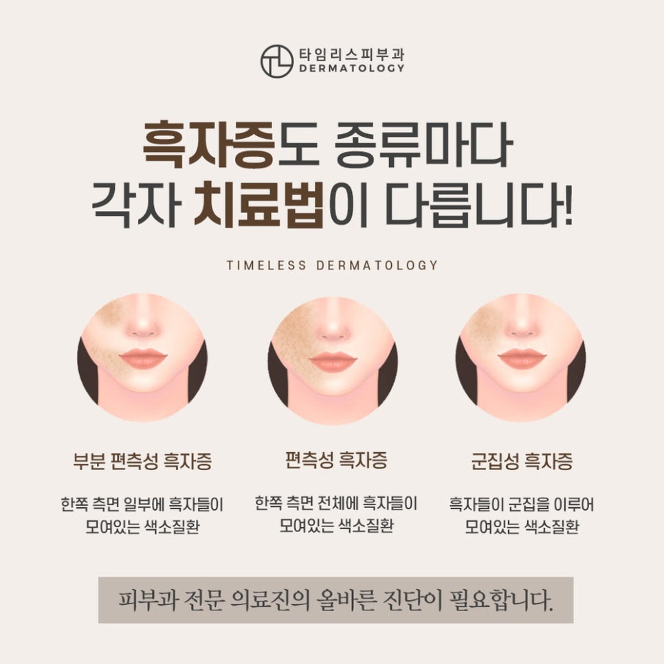 후천성오타모반 올바른 치료 방법으로 관련 이미지 4