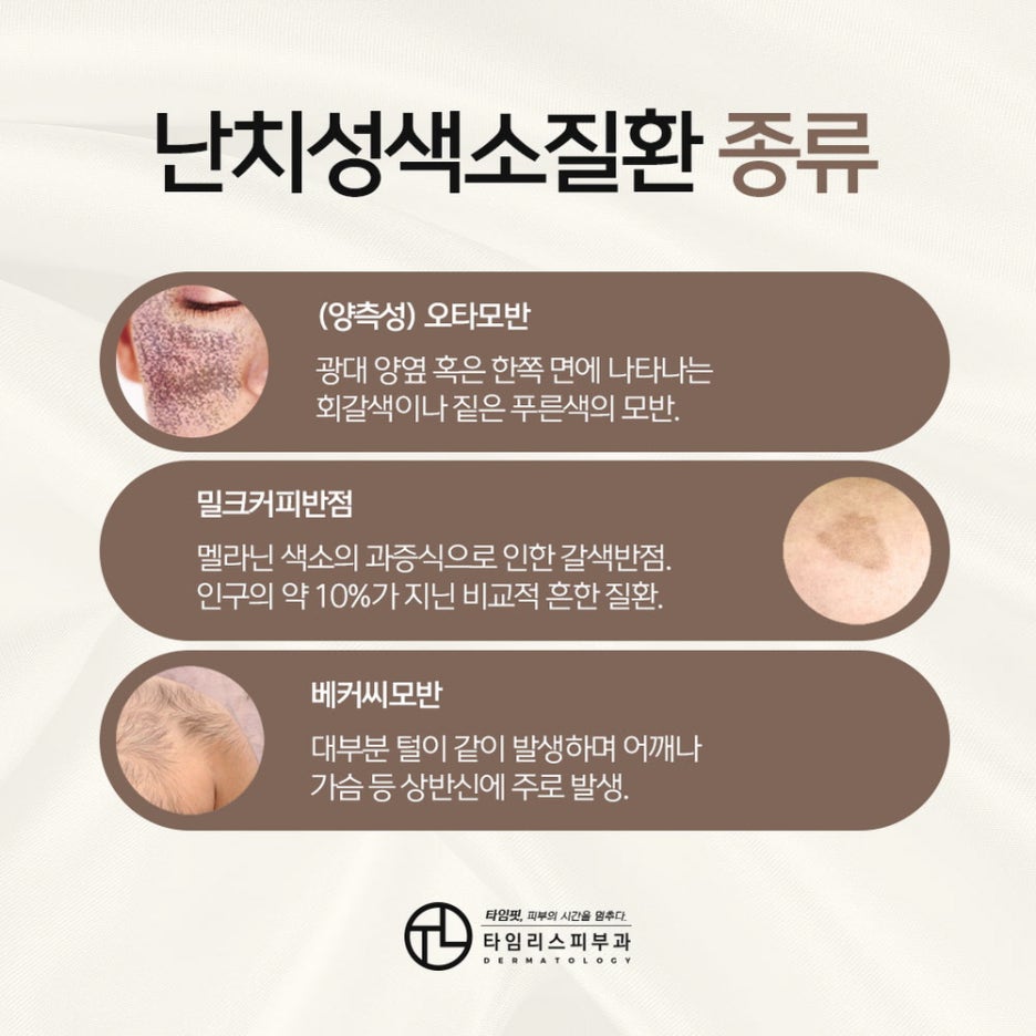 난치성색소질환 올바른 관리가 필요해 관련 이미지 3