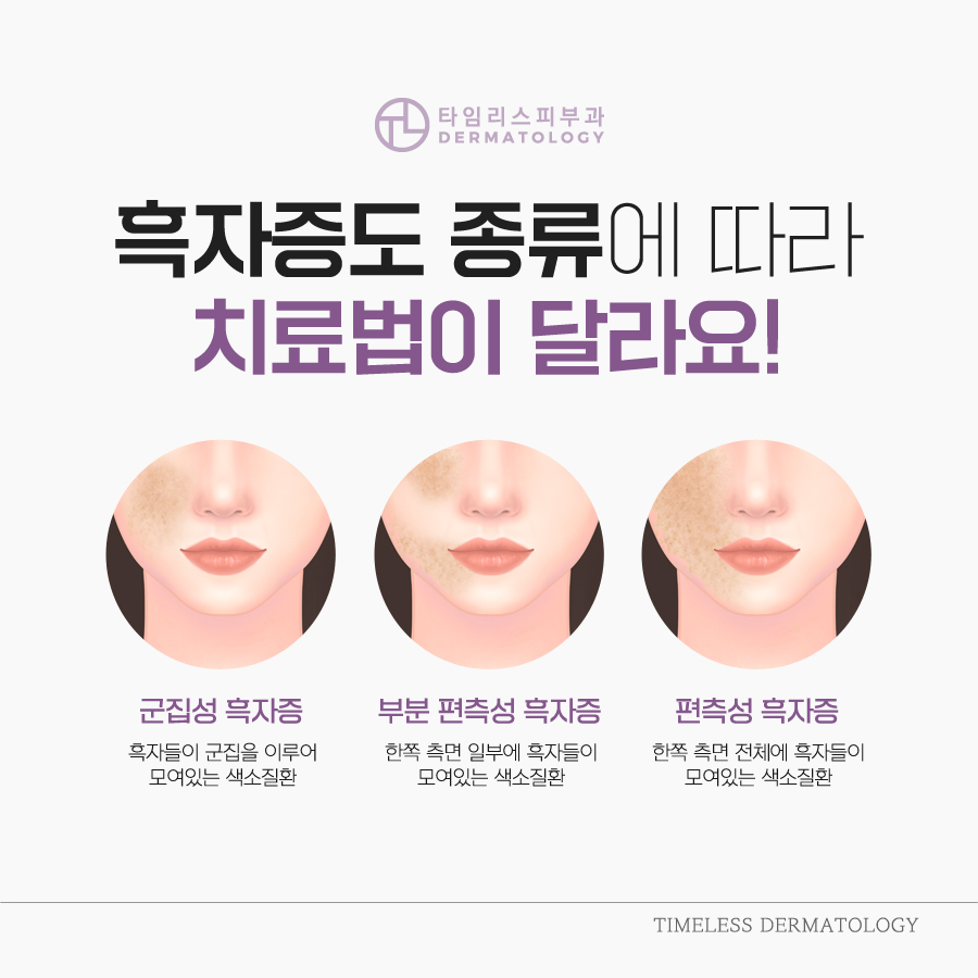 색소치료피부과 진단에 적합한 방법으로 관련 이미지 4