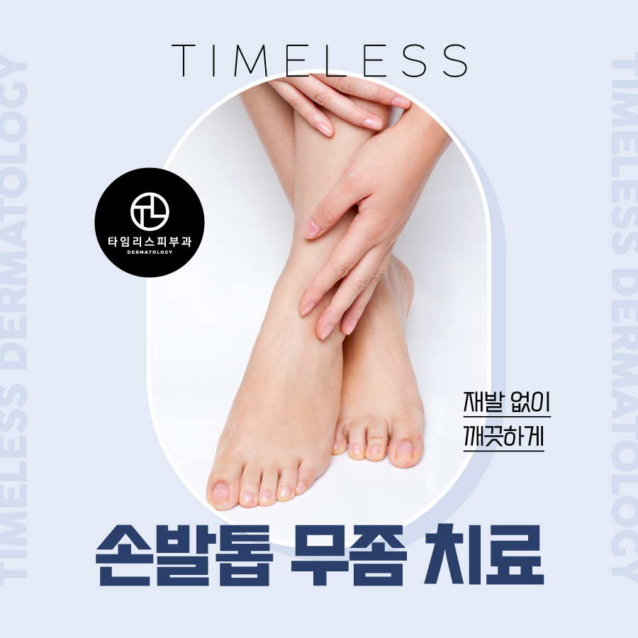 손발톱무좀치료 핀포인트ㆍ오니코레이저 통해 깨끗하게 관련 이미지 1
