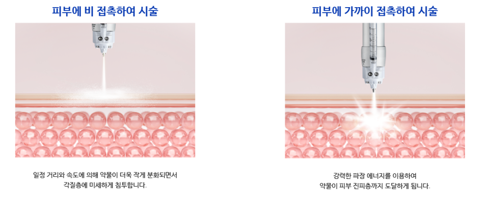 공덕큐어젯 모공과 흉터를 함께 본다면 관련 이미지 4
