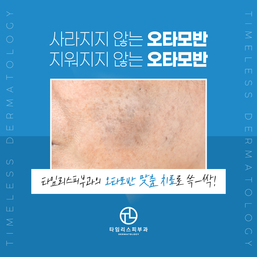 아현피부과전문의 잘하는곳은? 관련 이미지 5