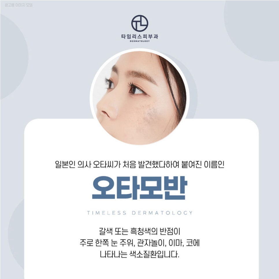 아현역피부과 색소질환 고민, 말끔히 해결! 관련 이미지 3
