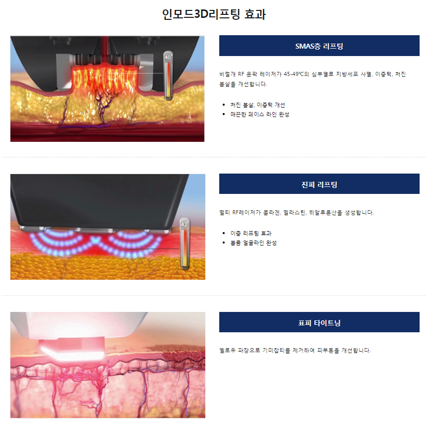 공덕피부과 타임리스에서 인모드리프팅후기 확인하세요 관련 이미지 6