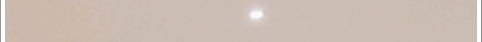 마포튠페이스 탄력이 줄어들어 고민이라면 관련 이미지 35