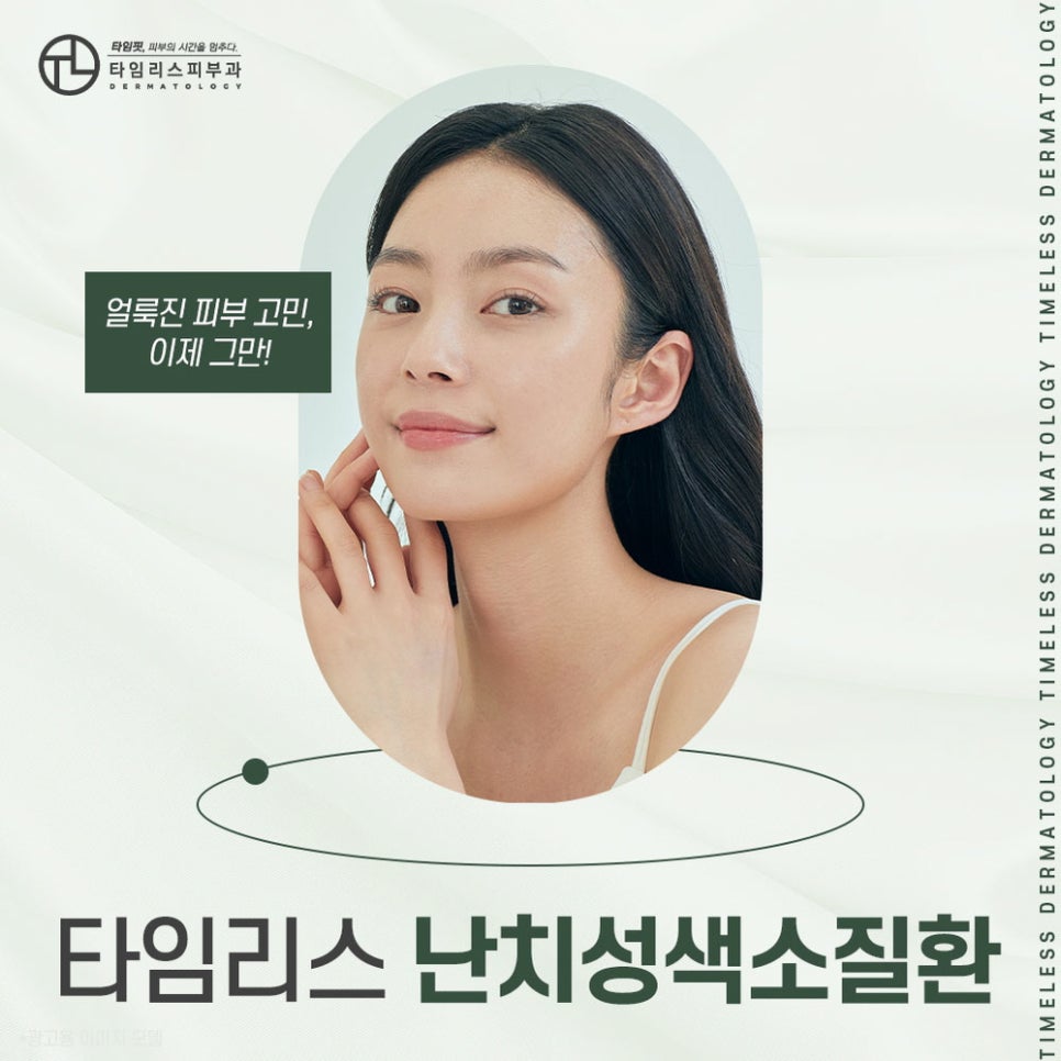 밀크커피색반점제거하고 고민을 덜어 관련 이미지 1
