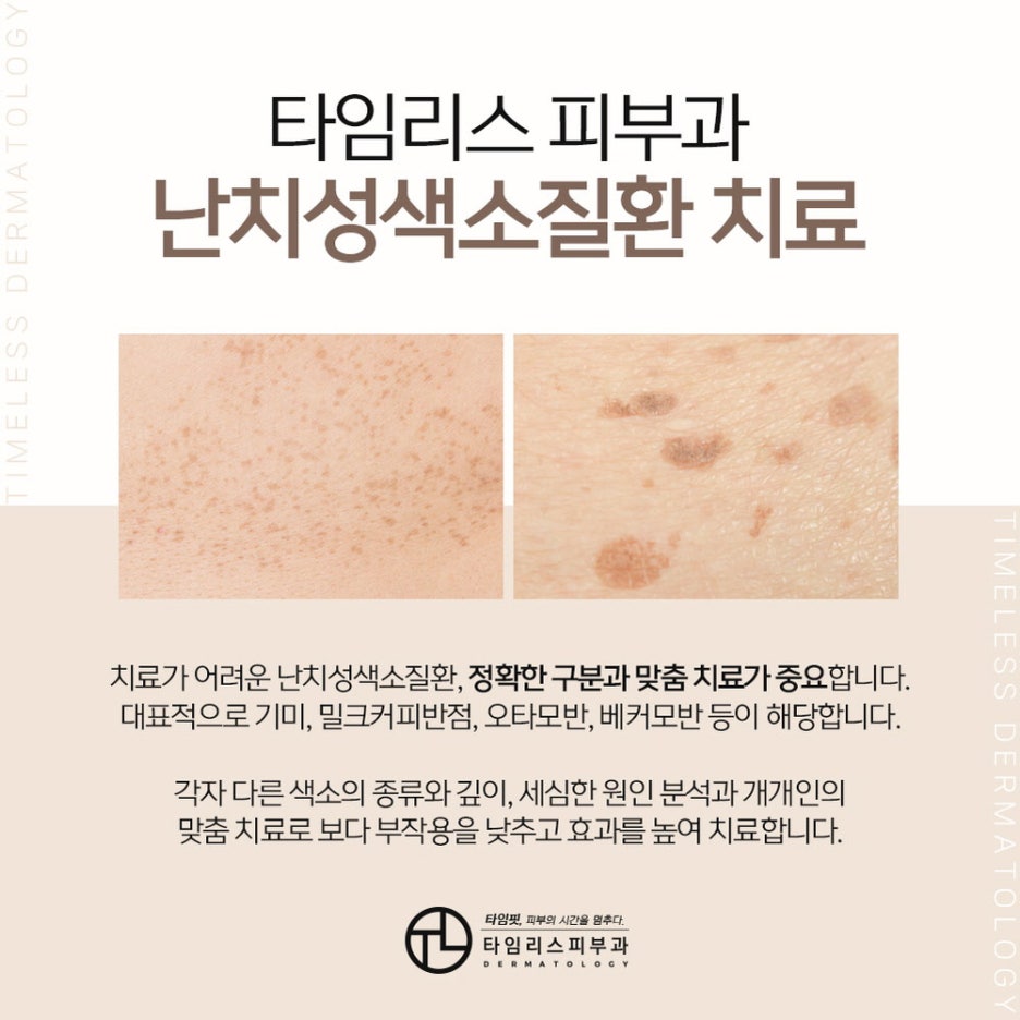 난치성색소질환 올바른 관리가 필요해 관련 이미지 2