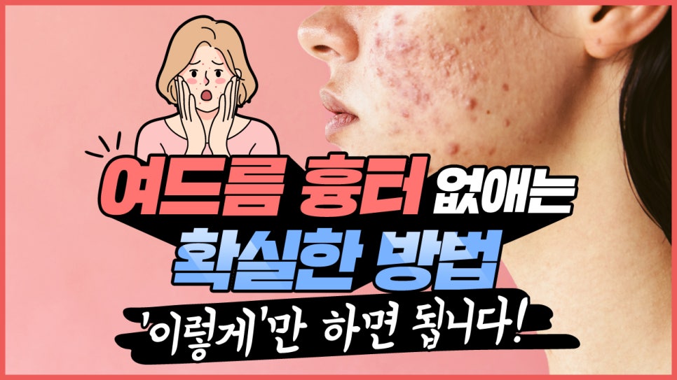 피부과의사도 시술 받는 여드름흉터 관리법 관련 이미지 1