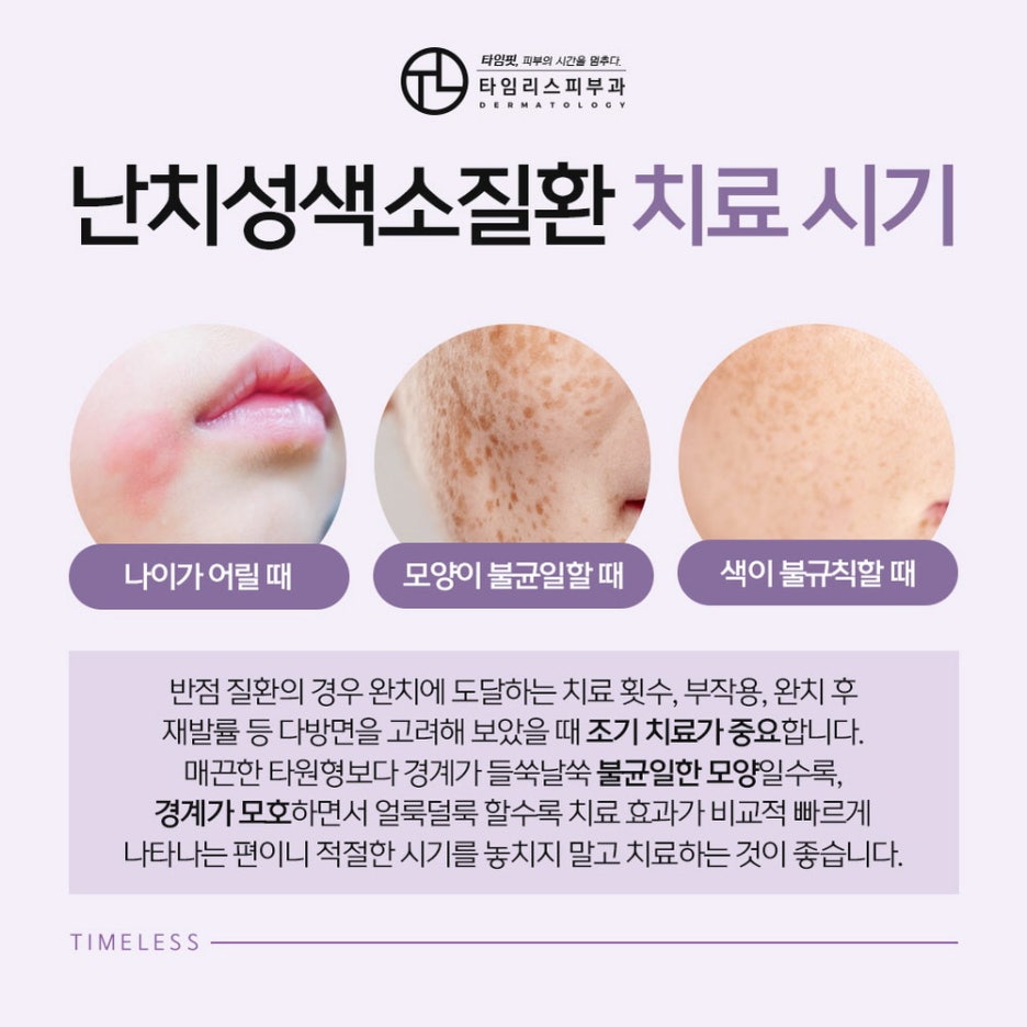 얼굴잡티제거비용, 방법이 궁금하다면? 관련 이미지 4