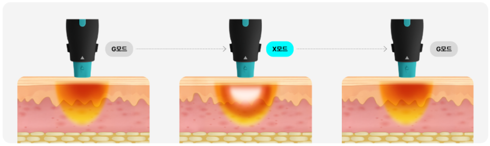 공덕올리지오X 자연스러운 탄력 변화를 원한다면 체크해야 할 기준 관련 이미지 5