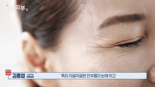 공덕피부과 필러 대신 쥬브젠?주름을 ‘채우는 방식’부터 다릅니다 관련 이미지 2
