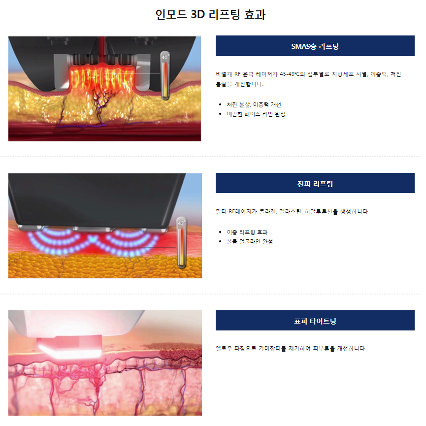 레이저리프팅 잘하는곳 타임리스피부과에서 이중턱 상담 관련 이미지 4