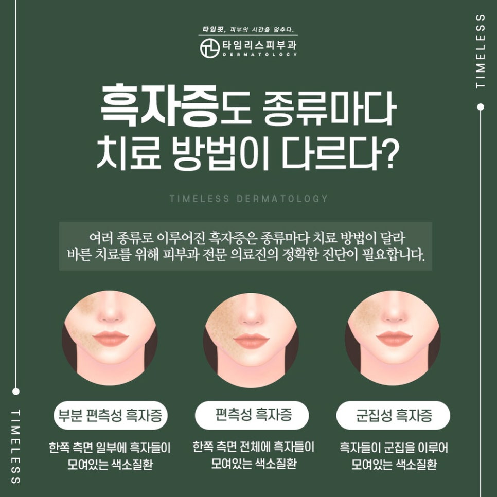 밀크커피색반점제거하고 고민을 덜어 관련 이미지 4