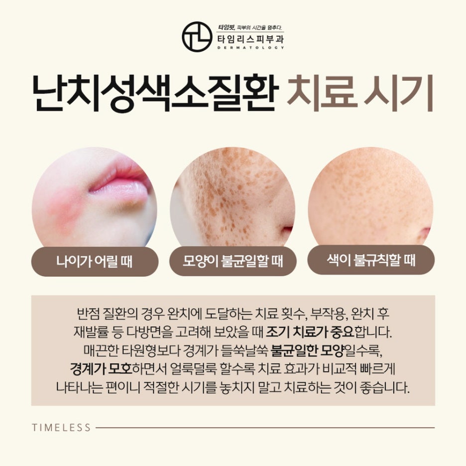 난치성색소질환 올바른 관리가 필요해 관련 이미지 4