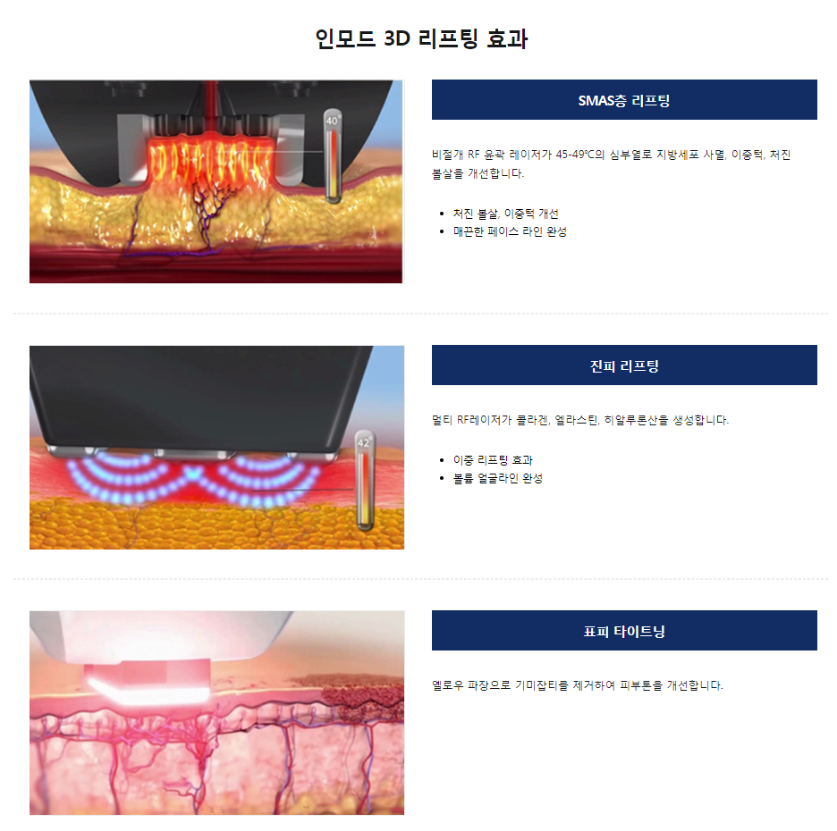 공덕피부과 세번당겨주는 인모드리프팅으로 동안만들기 관련 이미지 4