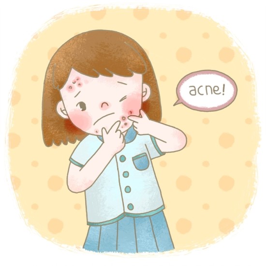 [마포/공덕/이대/아현역피부과] 타임리스피부과 여드름 자국 치료는 이렇게 받으세요 관련 이미지 1