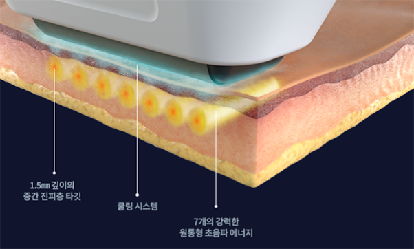 Why Are Thermage and Sofwave Discussed Together at Gongdeok Station Dermatology? image 3